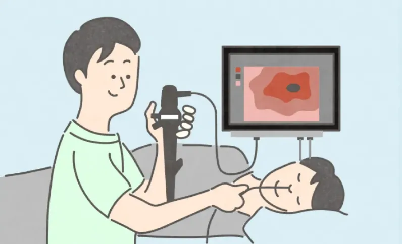 経鼻内視鏡検査のイメージ