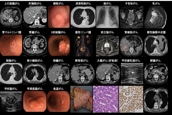 当院で発見されたがんの画像一覧