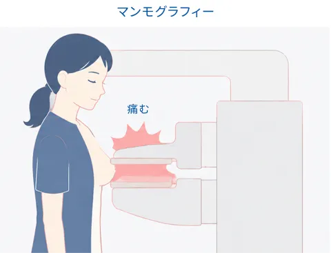 マンモグラフィー