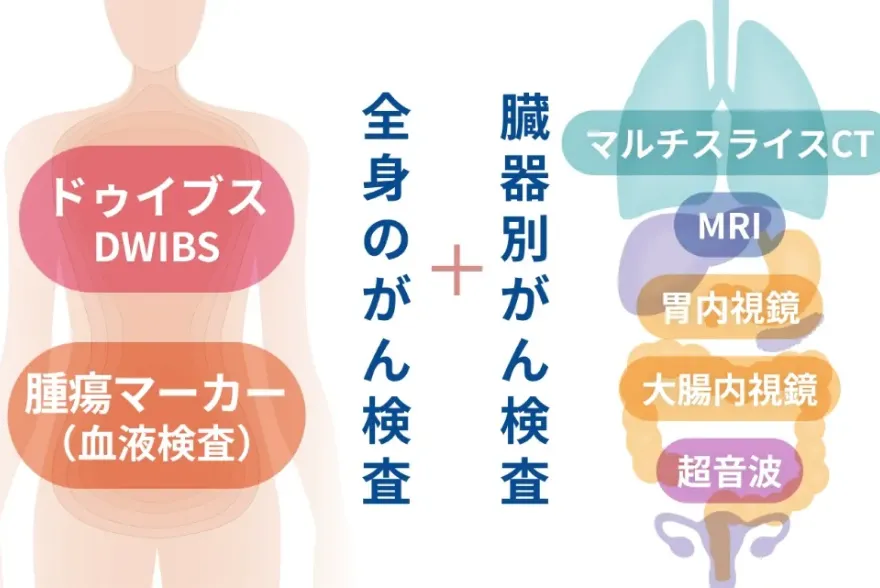 全身のがん検査＋臓器別がん検査