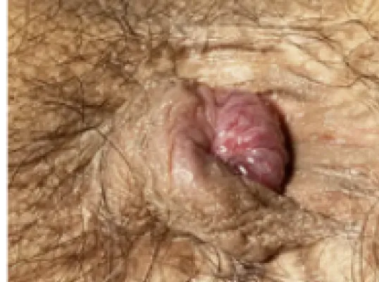 手術直前の症例写真