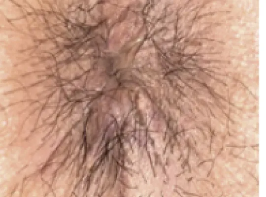 手術翌日の症例写真