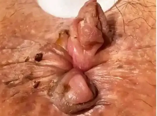 手術前の症例写真