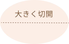 大きく切開する従来の切開法の図