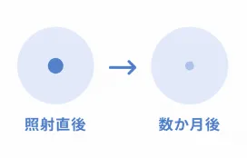 CO2レーザーでホクロを除去する図
